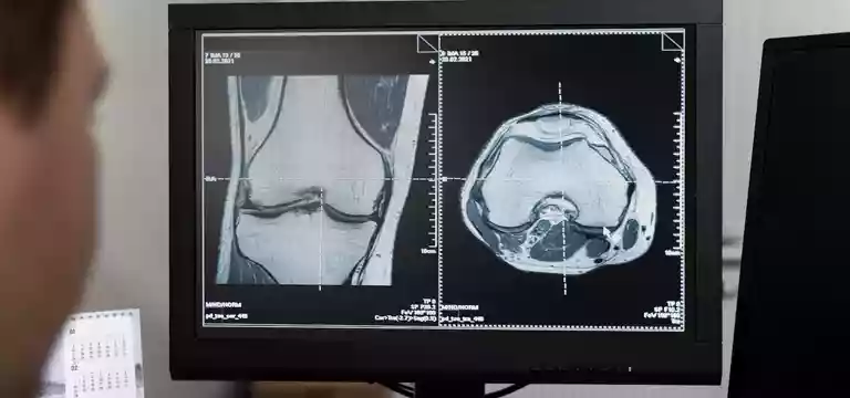 CT Scans for Abdominal Imaging: An Overview